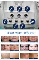 7 in 1 Intelligent Skincare RF Skin Detector Scrubber Hydro Hydra Hydrodermabrasion Facial Machine Skincare Machine Skin Rejuvenation SPA
