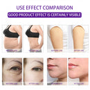 80 in 1 80K cavitation RF Skin Tightening and Weight Loss Lipolaser Pad vacuum slimming device AS92