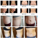 6 in 1 80K Cavitation Vacuum RF Lipolaser Body Slimming Machine AS82