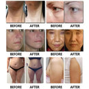 80khz cavitation Beauty Equipment 6 In 1 Cavitation Rf Machine For Weight Loss And Body liposuction Slimming AS91