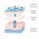 Laser Skin Whitening Tattoo Removal Machine