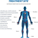 Physio Shockwave Shock wave Therapy Ondas De Choque Focal Erectile Dysfunction Machine SW7S