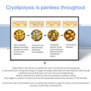 Top Cryotherapy Cryo skin Cooling Cryoskin Tightening Thermal T Shock System fat reduction Beauty devices body slim care machine