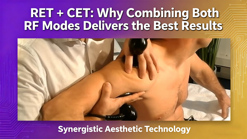 RET + CET: Why Combining Both RF Modes Delivers the Best Results