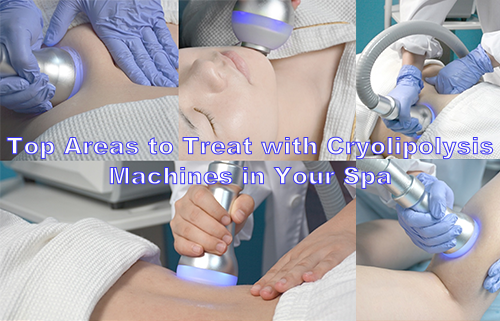 Top Areas to Treat with Cryolipolysis Machines in Your Spa