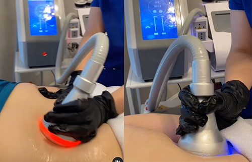The Science Behind Hot and Cold Contrast Therapy for Slimming