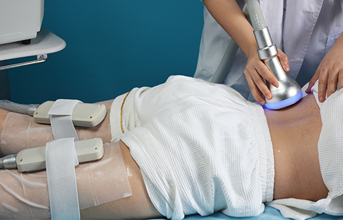 How to Combine Cryoskin and EMS for Faster Body Sculpting Meta
