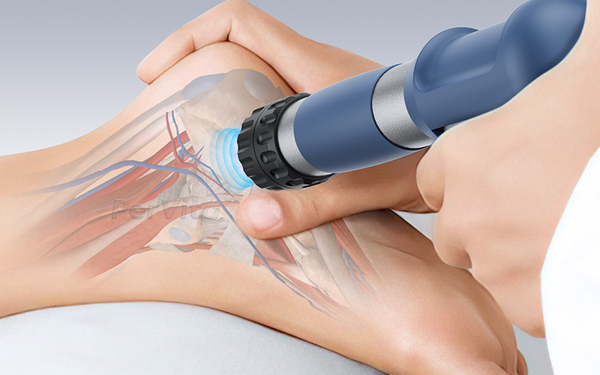 The Best Shockwave Therapy Machines for Foot and Ankle Specialists