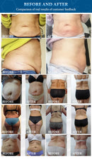 NEWBELLE 24 air bags 3 in 1 compression therapy lymphatic drainage presoterapia pressotherapy machine BR611