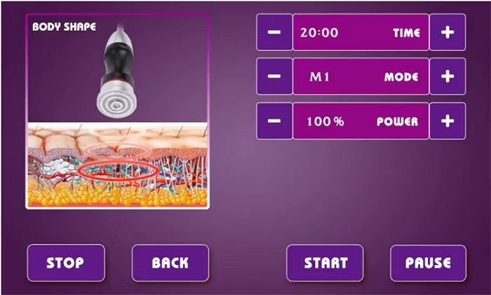 Radiofrequency Body Cavitation Vacuum Fat Removal Anti-Aging RF Skin Tightening Face Lifting Radio Frequency Slimming Machine（副本）