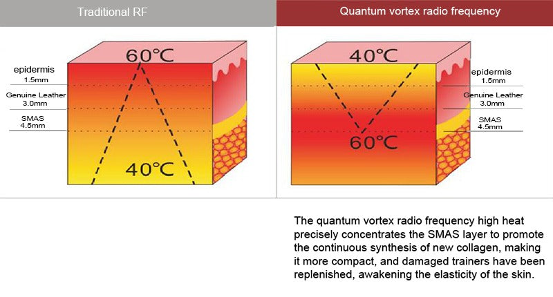 Radiofrequency Body Cavitation Vacuum Fat Removal Anti-Aging RF Skin Tightening Face Lifting Radio Frequency Slimming Machine
