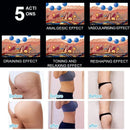 Inner Roller Machine Cellulite Reduction Wrinkle Removal Muscle Stiffness Soreness Beauty Weight Loss Machine