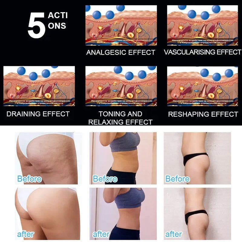 Inner Roller Machine Cellulite Reduction Wrinkle Removal Muscle Stiffness Soreness Beauty Weight Loss Machine