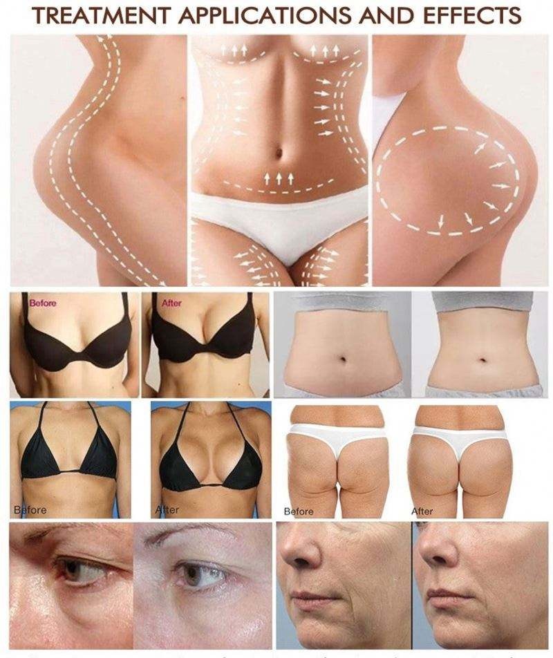 Vacuum Butt Lifting Enlargement Cupping Buttock Therapy Breast Enhance Body Massage Lift Intended&nbsp; Machine BR-08