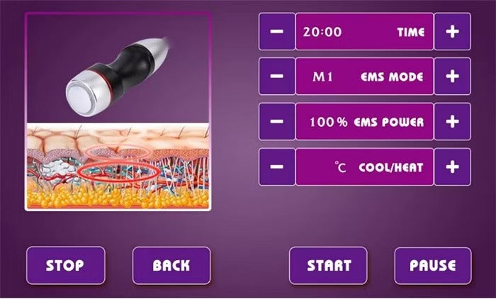 Radiofrequency Body Cavitation Vacuum Fat Removal Anti-Aging RF Skin Tightening Face Lifting Radio Frequency Slimming Machine（副本）