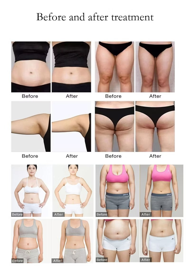 EMS RF Body Sculpt Pads & Inner Ball Roller Muscle Stimulating Cellulite Massagger Cavitation RF Body Massage Machine