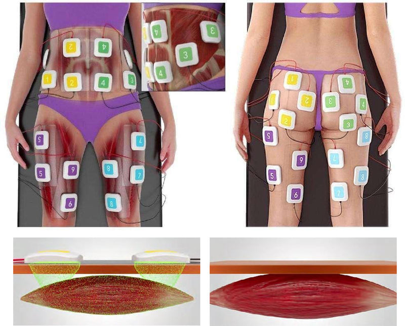 16 Handles ID Flex Painless 3d Body Sculpting Deep Heating Fat Burning Slimming Machine Rf Skin Tightening Trusculpt Reduction