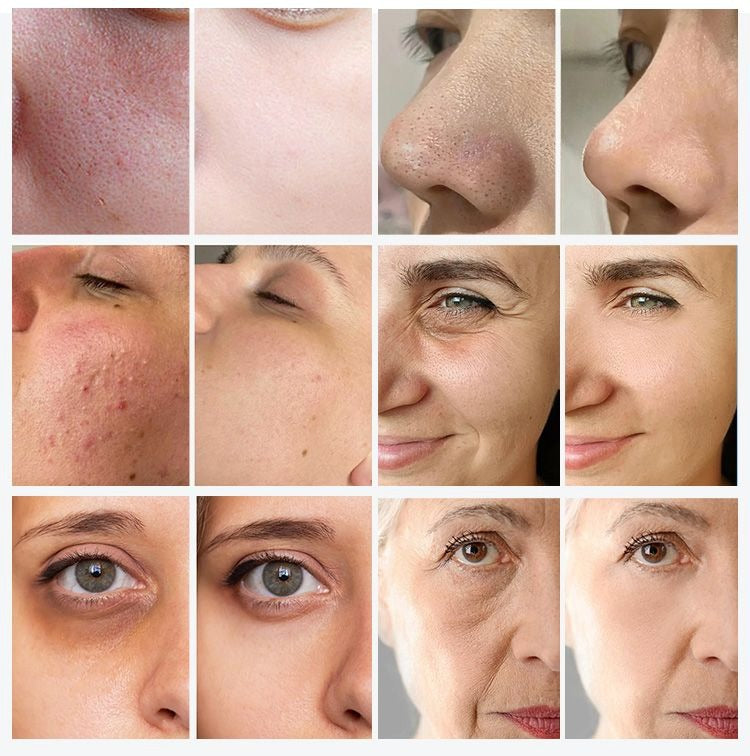 Professional Non-Invasive 12.1 Touch Screen Luxspa Master 8-Handle Facial Device for RF Dermabrasion Acne Wrinkles Dark Circle Removal Machine SPAM68