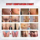 Wrinkle Removal Inner Ball Roller Tester laser vacuum RF body slimming beauty Machine