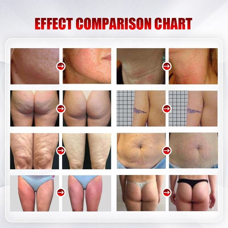 Wrinkle Removal Inner Ball Roller Tester laser vacuum RF body slimming beauty Machine