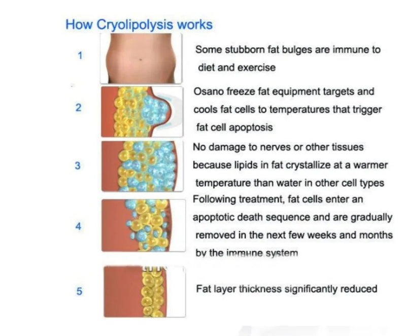 360 angle surrounding cryolipolysis cryoskin body slimming cooling skin tightening machine AGE-PRO