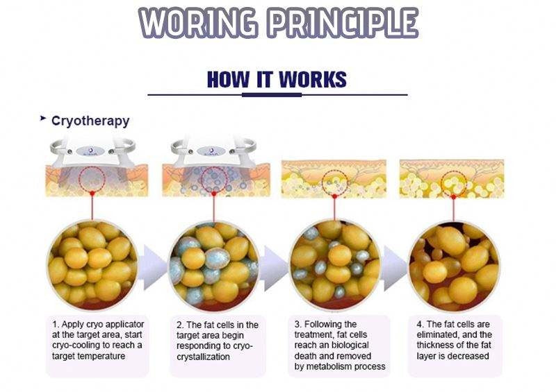 360 angle surrounding cryolipolysis cryoskin body slimming cooling skin tightening machine AGE-PRO