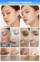 15 in 1  Multifunctional ems RF facial skin tightening machine hydra diamond dermabrasion for spa facial beauty