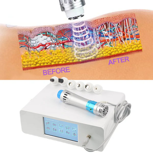 Physio Shockwave Shock wave Therapy Ondas De Choque Focal Erectile Dysfunction Machine SW7S