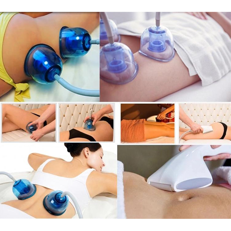 Breast Enlargement Vacuum Breast Massage Cupping Treatment Machine Vacuum Machine