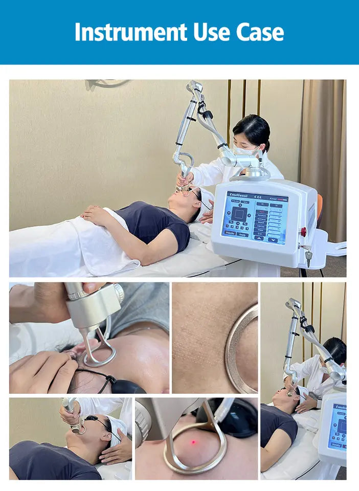 Acne scar removal skin rejuvenation stretch marks removal portable fractional 4d co2 laser wrinkles machine