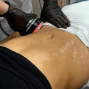 6 in 1 Cavitation System for Face and Body