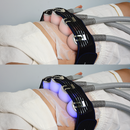 5 Handles Hot Cold Thermal Cryolipolysis Cryotherapy Cryoskin Cryo Slimming T Skin Shock Machine C11