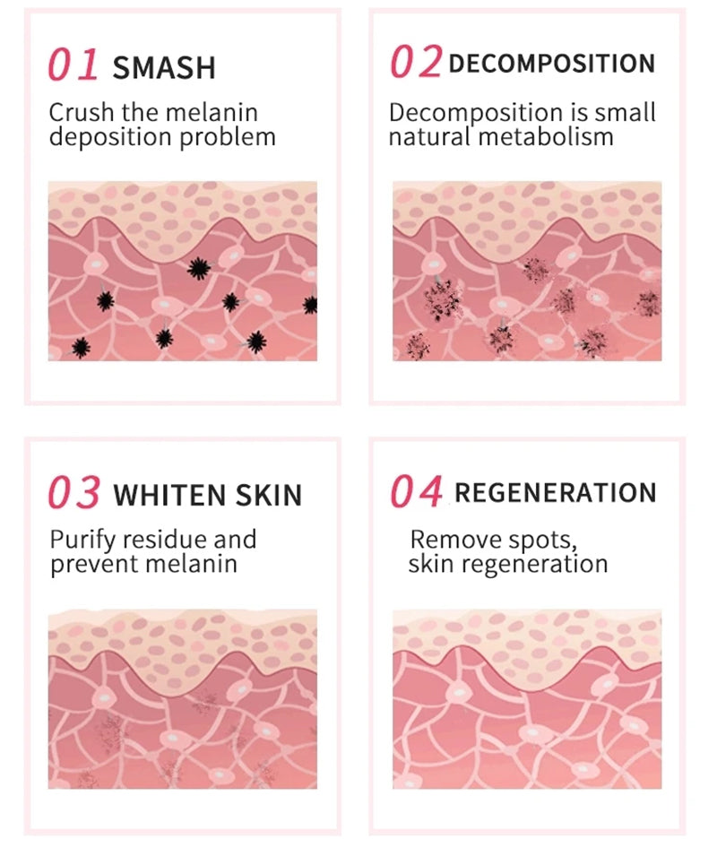 Pico Laser Tattoo Removal Machine for Skin Resurfacing and Pigmentation Removal Tattoo Machine