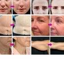 New Technology Skin Rejuvenation RF Hifu Machine with 7D Hifu Smas Lift Machine