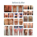 NEWBELLE Portable 2 in 1  Shockwave Heat Roller Ball Lymphatic Drainage Massager Shock Wave Physical Rehabilitation Therapy Machine HQL001