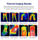 Professional Physiotherapy Magnetotherapy Magnetic System Deep Muscle Stimulation and Nerve Magnetic Physical Therapy MT-72