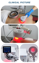 Magneto Therapy could treat frozen shoulder physio treatment Near-infrared spectroscopy magnetotherapy machine PMST-4 NEO
