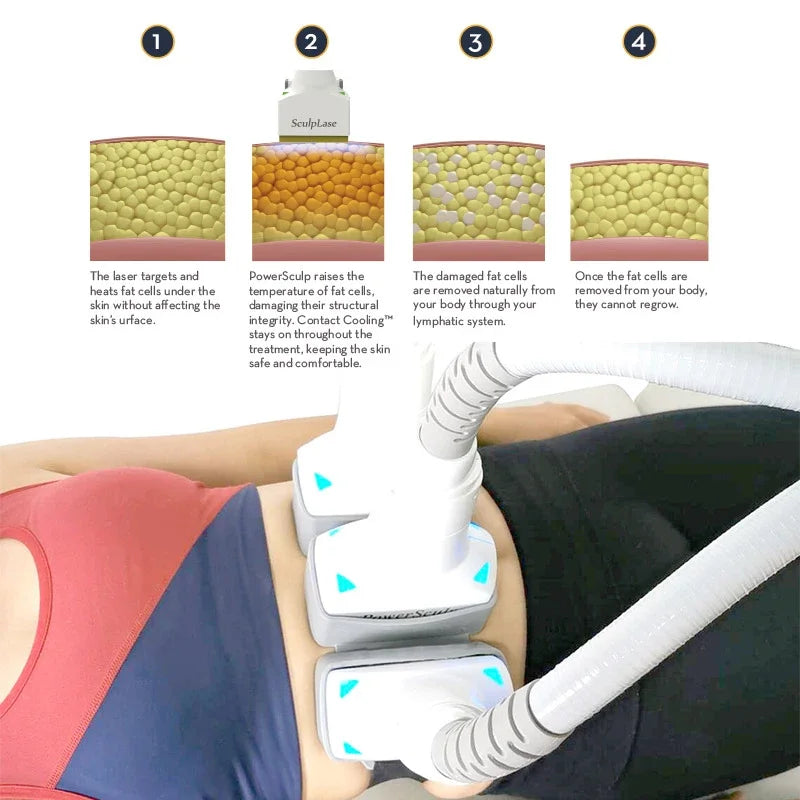 High Power Permanent Cellulite Removal Ultrasonic Vacuum Cavitation Hine For Arms Double Chin Thighs