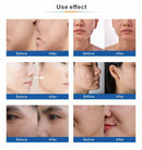 Oxygen Facial Machine Water Aqua Jet Peel Micro Dermabrasion Diamond Oxygen Facial Therapy Oxygen Jet Peel Machine