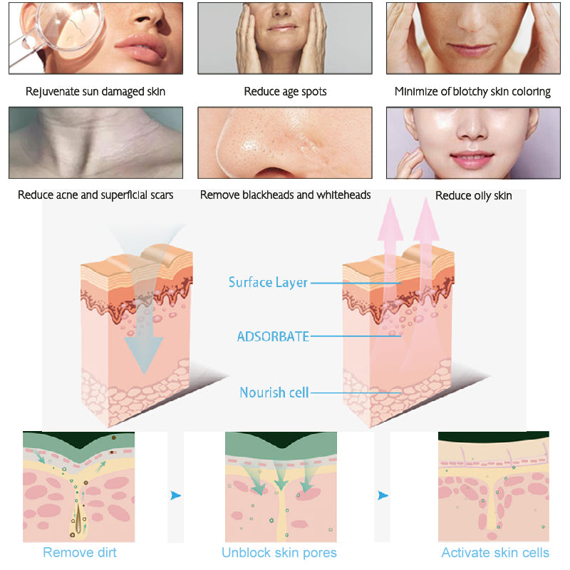 Factory 0 Defeat Hidrafacial Hydra 2023 Hydradermabrasion Oxygen Jet Water Aqua Dermabrasion Peeling Hydro micro Facial Machine