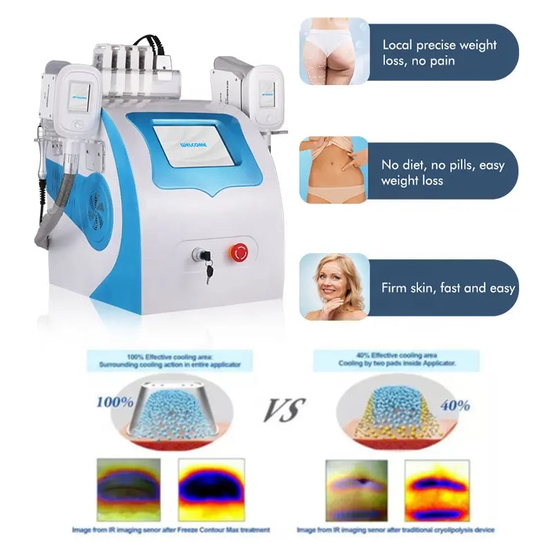 Summer Promotion kryolipolyse 6 in 1 Cryo cool max freeze cryoskin lipolysis Frozen Fat Laser Radiofrequency Cavitation vacuum