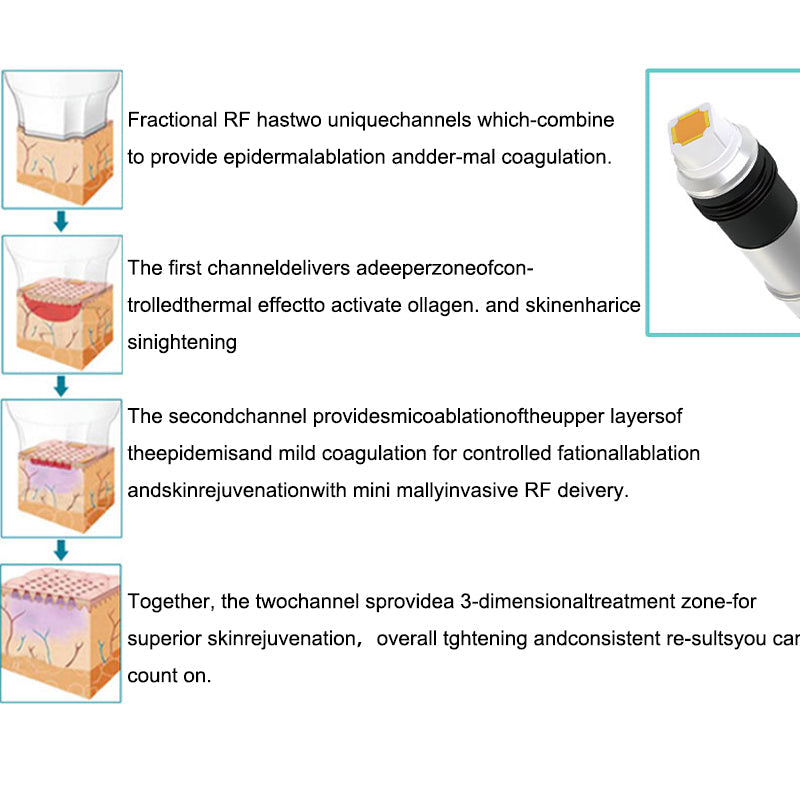 Skin Rejuvenation Wrinkle Removal Skin Tightening Rf Beauty Machine Rf Fractional Microneedle Acne Removal Skin Care