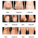 6IN1 RF Ultrasonic Cavitation 40K Vacuum Laser Body Slimming Machine Facial Lift