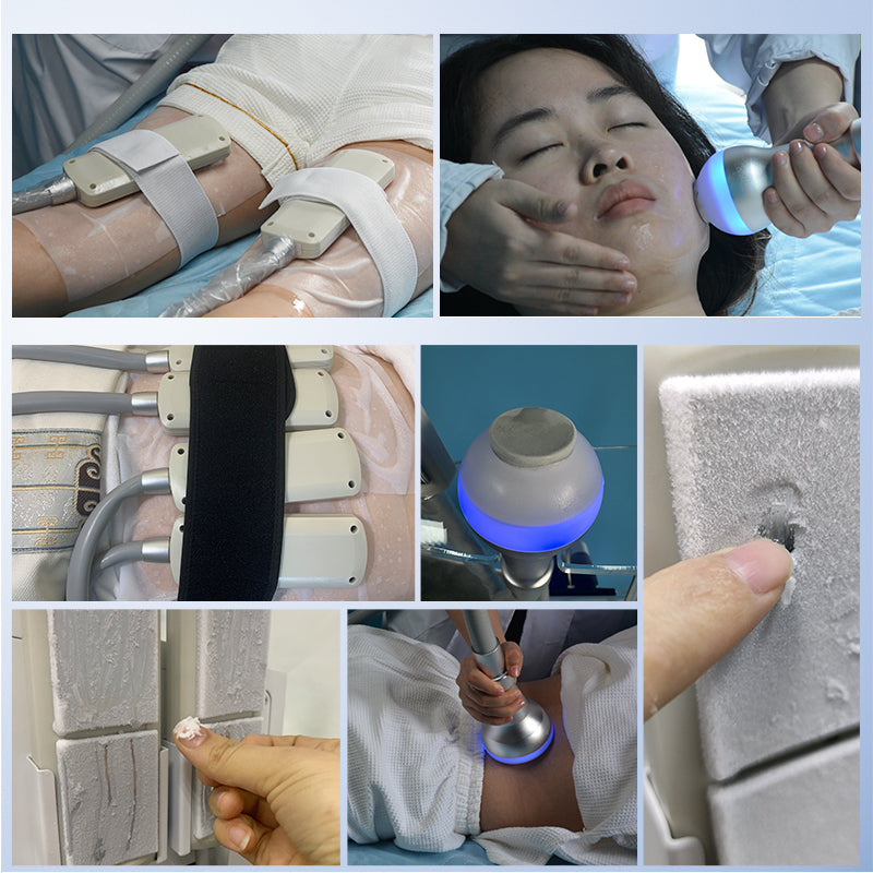 Cryotherapy Cryo toning facials Cryogenic skin tightening rejuvenation therapy treatment sculpting lipolysis slimming cryoskin