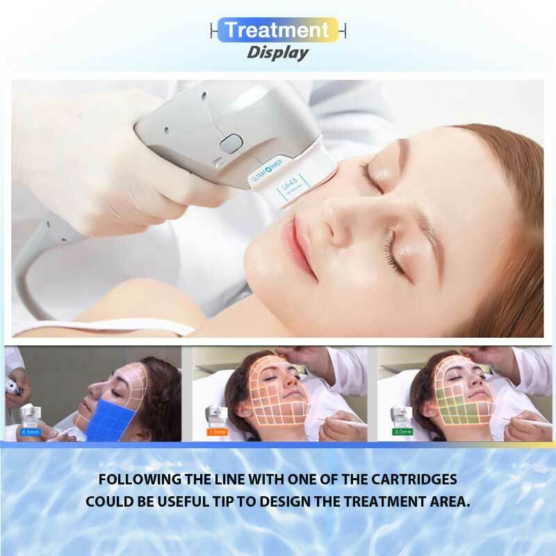 7D HIFU Ultrasound Machine Wrinkle Removal Face Body Tightening W/ 7 Cartridges