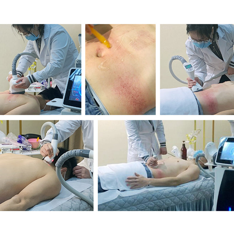 Velashaping 4 handles cavitation Massage vacuum roller RF IR velaslim 3 slimming machine Weight Loss Fat Removal advice