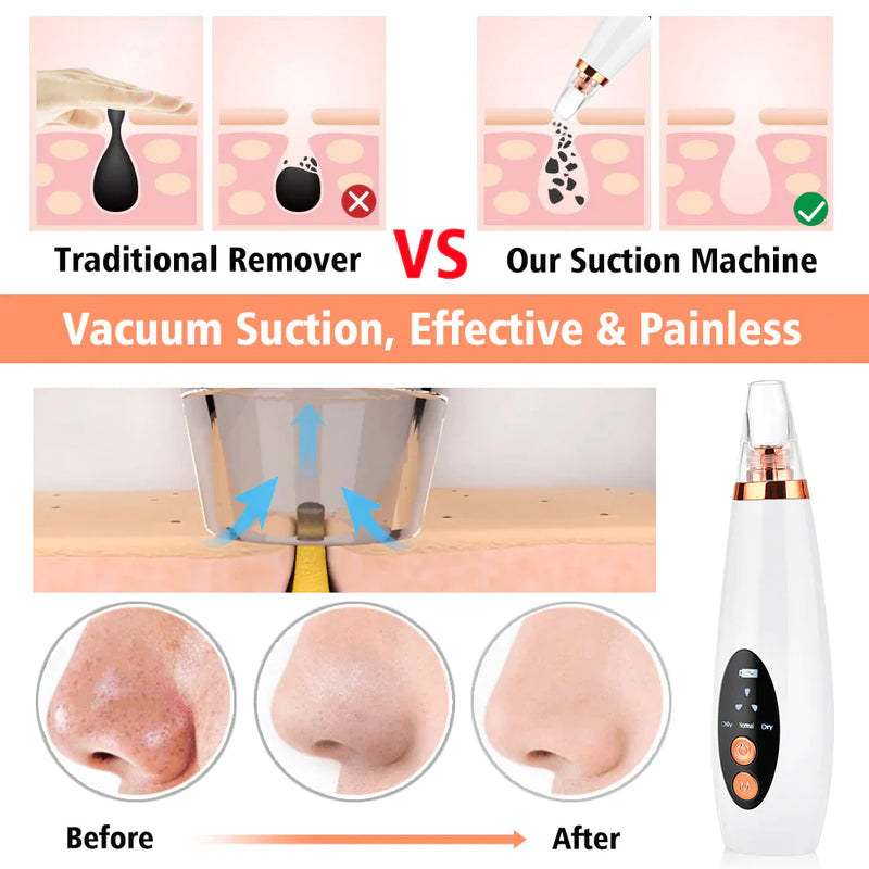 Electric Blackhead Remover Pore Cleaner