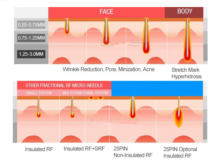 Skin care SRF Cryo PDT face Micro Needle beauty equipment micro needling high quality derma pen needle machine