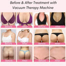 Hands-Free Body Sculpting Vacuum Therapy Machine with XL Cups