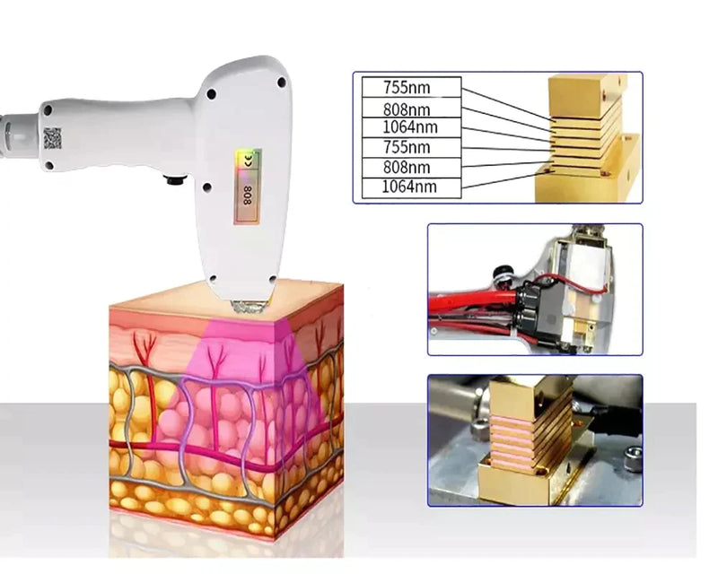 Luxury Portable Diode Laser Hair Removal Machine